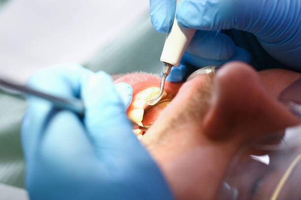 Best Emergency Treatment for Dental Infections or Abscesses in Harper Woods, MI