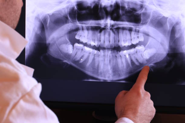 Best After-Hours Dental Trauma Care in Harper Woods, MI